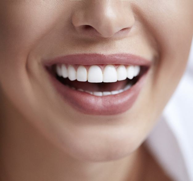 Closeup of a beautiful smile thanks to cosmetic dental bonding in Jacksonville