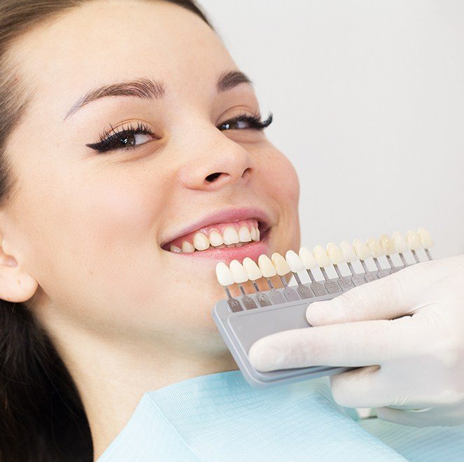 Woman's smile compared with porcelain veneer shade chart