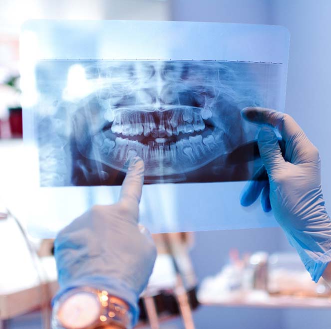 Emergency dentist in Jacksonville pointing at and holding an X-ray