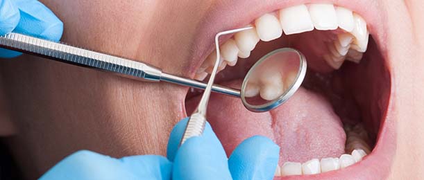 Woman with lost dental crown covering her smile
