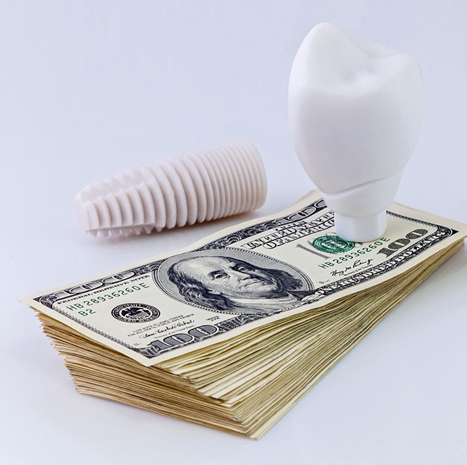Model of a dental implant in Jacksonville on top of money