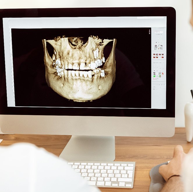 Dentists examining 3D cone beam scan of a patient’s mouth
