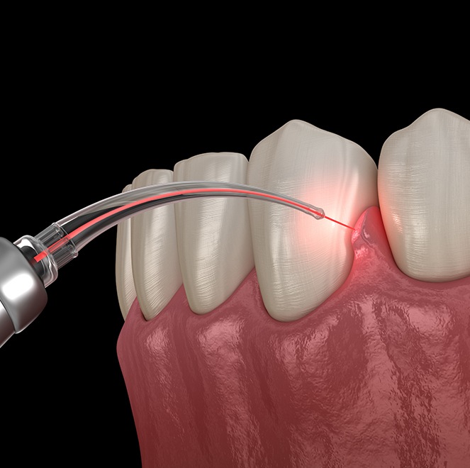 Patient receiving laser dentistry treatment