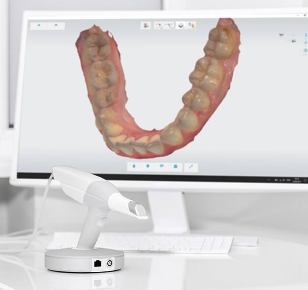 Digital impression of smile on chairside computer