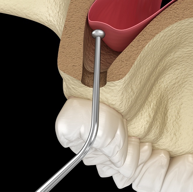 Animated equilibration treatment