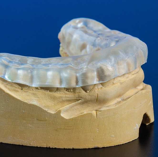 Model smile with occlusal splint