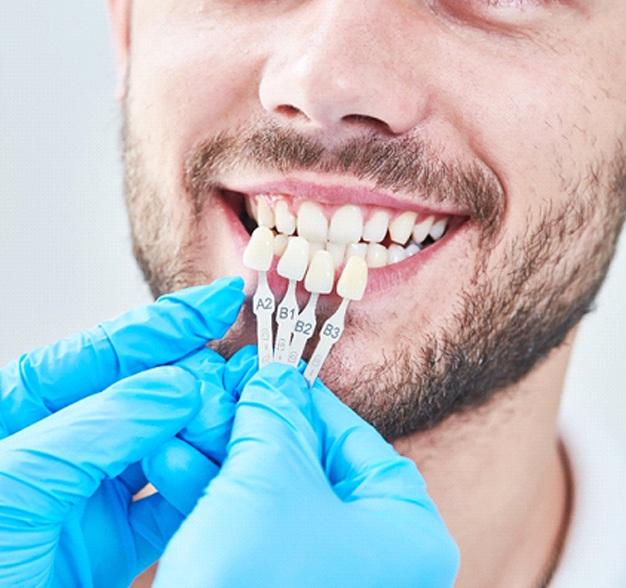 Male patient being color matched for veneers